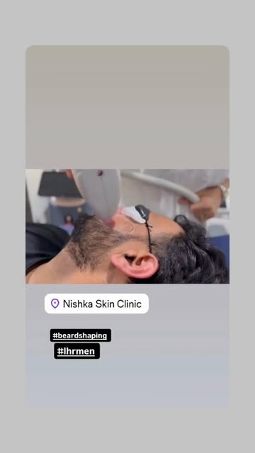 🔥 Sharp beard. Cleaner look. Laser precision.
#skinboostertreatment #ᴠɪʀᴀʟᴘᴏsᴛ #skintreatment #heal