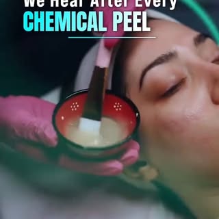 Just had a chemical peel? Here’s what NOT to do! 🚫✨

☀️ Avoid direct sun exposure
🧴 Pause your reg