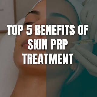 ✨ Top 5 Benefits of Skin PRP Treatment ✨

Give your skin a natural boost with PRP therapy — a regene