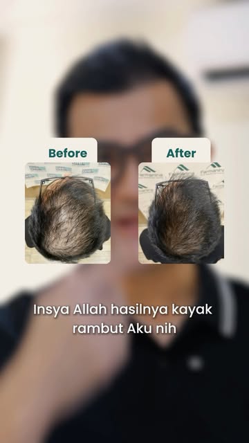 Rambut terasa makin menipis? Saatnya kasih perhatian lebih pada akar rambut. ✨
Haircell membantu mer