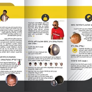 ስለ የረቀቀ የፀጉር ታቱ(Scalp Micropigmentation) ማወቅ ይፈልጋሉ?👇
🙋🏽‍♂️የረቀቀ የፀጉር ታቱ ምንድን ነውና ሌሎችም
🙋🏽‍♂️ከስራው 