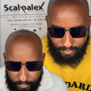 2nd session of SMP 

visit www.scalpalex.com for more info

2023 MoMs winner
@ghostpigment pro artis