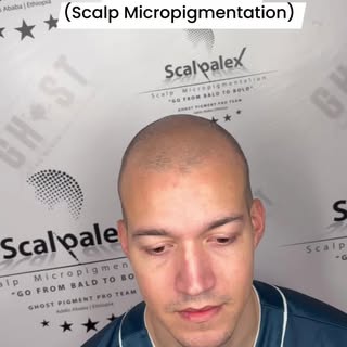የረቀቀ የፀጉር ታቱ(Scalp Micropigmentation) 

visit www.scalpalex.com for more info

2023 MoMs winner
@gho