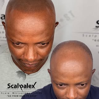2nd session Norwood 7✅

visit www.scalpalex.com for more info

2023 Meeting of Minds winner
@ghostpi