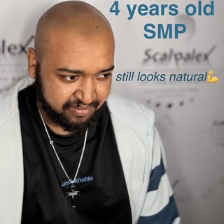 4 years old SMP. still going strong without a touch up. looks so natural and undetectable