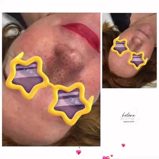 ✨ Le maquillage permanent des lèvres redonne de la fraîcheur, sublime votre sourire et reste élégant