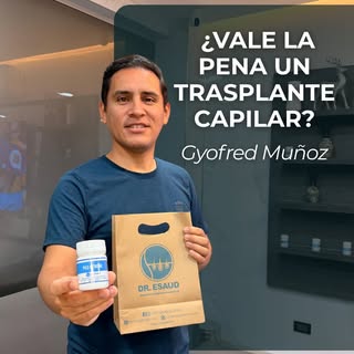¿Vale la pena un trasplante capilar? 🤔 Mira el increíble resultado y proceso de @gyofred años despu