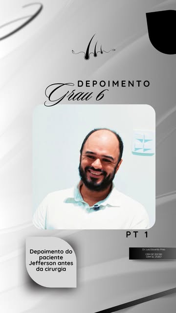 Cada transplante capilar começa muito antes da cirurgia. 

Começa com uma história, uma decisão e a 