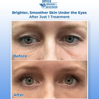 Brighter, smoother-looking skin after just one treatment. ✨

This before-and-after, performed by our