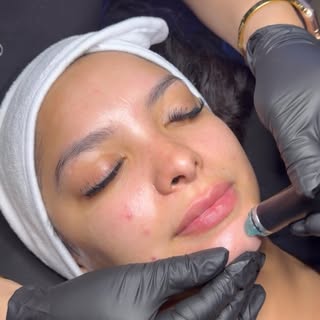 HydraFacial 
Refresh • Hydrate • Glow

• Deep cleanses pores
• Gently exfoliates
• Instantly hydrate