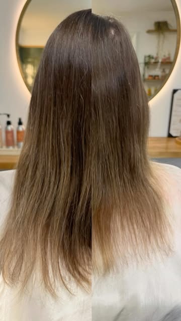 Over the moon with this client’s results 🙌🏻

In roughly 6 months of treatment, we:

🌱 Addressed i