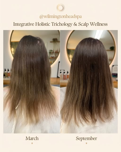 Over the moon with this client’s results 🙌🏻

In roughly 6 months of treatment, we:

🌱 Addressed i