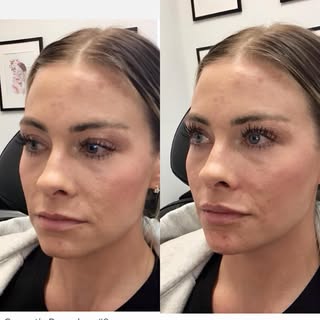 SHOOK. We did the TINIEST adjustments on this babe and it had massive impact. A little hydration for