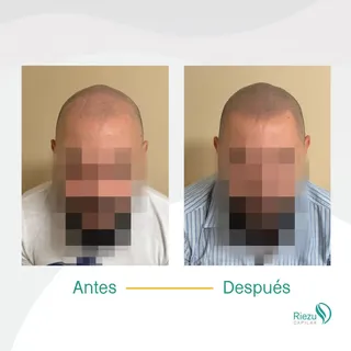 Cero pelo. Cien por cien intención. ✏️
El efecto rapado no perdona la imprecisión: cada punto tiene 