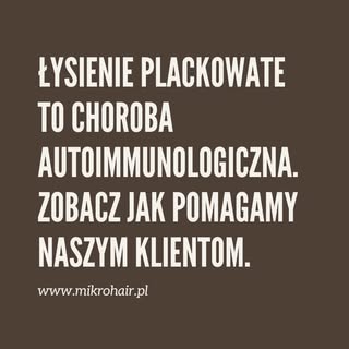 Łysienie plackowate? Zobacz, jak wygląda skuteczny kamuflaż! 🔥

Łysienie plackowate to choroba auto