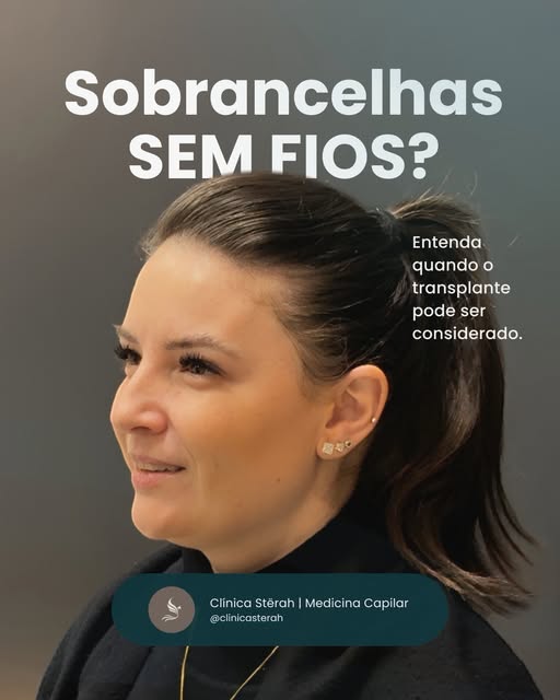 Nem toda falha na sobrancelha é falta de fio.

Depois de anos sem retirar, algumas áreas simplesment
