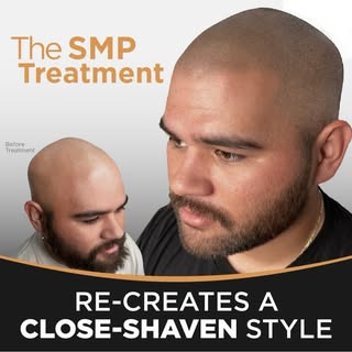 Ditch the hat for Summer! 🧢 #Call me 435-629-7800
#smputah #scalpmicropigmentationutah #microdotstu
