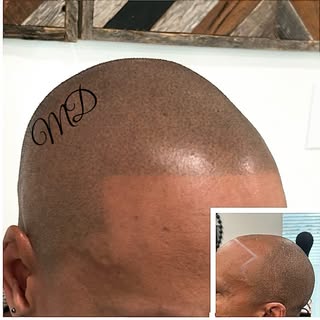 Building hairlines over here! Dot • Dot • Dot• Done! #smputah #smputahartist #microdotstudio #whynot
