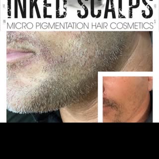 Do you struggle to grow a full stubble ?
If so at inked scalps dewsbury we have the answer…. 

No pa