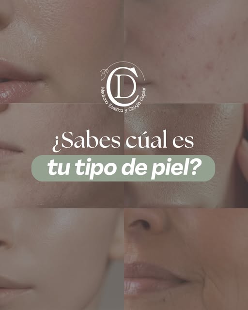 ¿𝘾𝙊𝙉𝙊𝘾𝙀𝙎 𝙏𝙐 𝙏𝙄𝙋𝙊 𝘿𝙀 𝙋𝙄𝙀𝙇?🤔

Antes de preocuparte por cuál producto de Skincare c