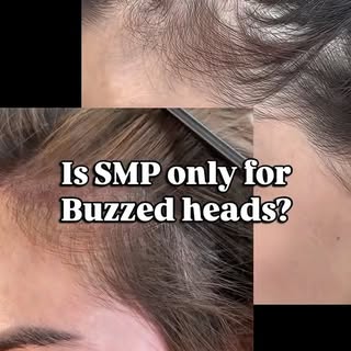 The biggest misconception about SMP? That you have to shave your head.

You don’t.

Whether you’re d