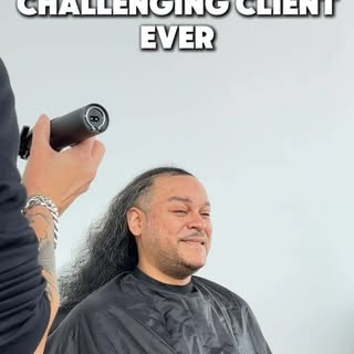 For 20 years, he hid beneath a hat.

His scalp presented some THE most challenging conditions I’ve e