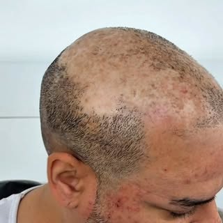 Part 2! Remember my most challenging client?

This is why I never give up.

The best part isn’t the 