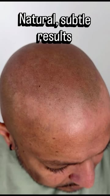 Subtle. Natural. Undetectable.

When your client looks in the mirror and says, “It looks like hair.”
