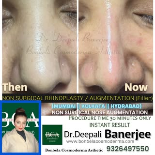 Contact us 📞 9326497550 | 6291967043