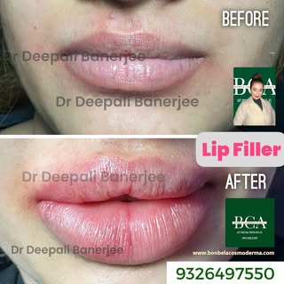 Book your appointment Now 9326497550