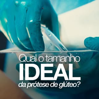 Qual é o tamanho ideal da prótese de glúteo?
Nem sempre o maior volume é o melhor.
Diferente da mama