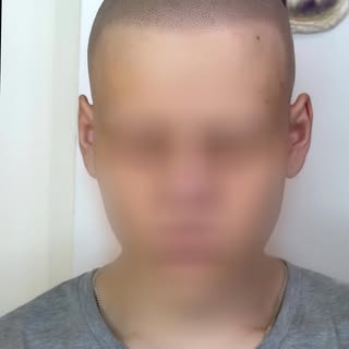 Интересная  работа,  сделана для Паши . Scalp micro  pigmentation by tattooist Afanasev Andrey 😉. #