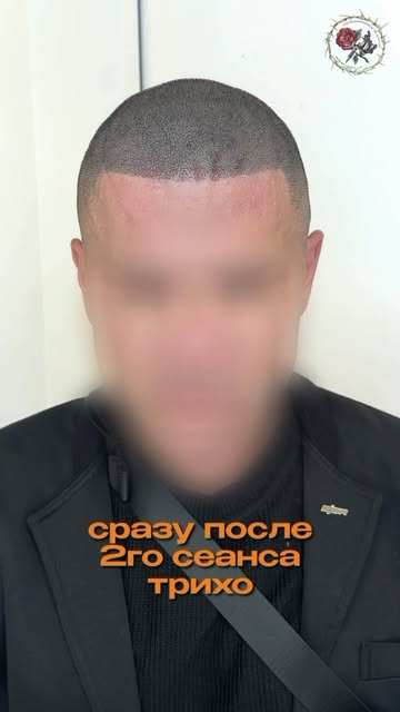 Есть парни кто именно хочет только прямые линии и им пох.. , что ты скажешь что это «шлем» ( передня