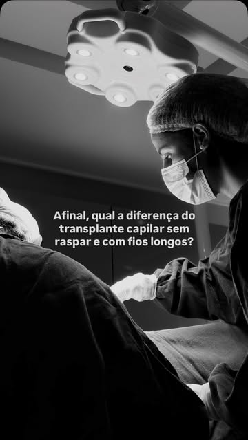 Qual a diferença do transplante capilar sem raspar e com fios longos?