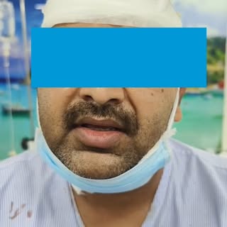 Advance Hair Treatments from our doctor team at
International standards in Indian price.
.
Contact u