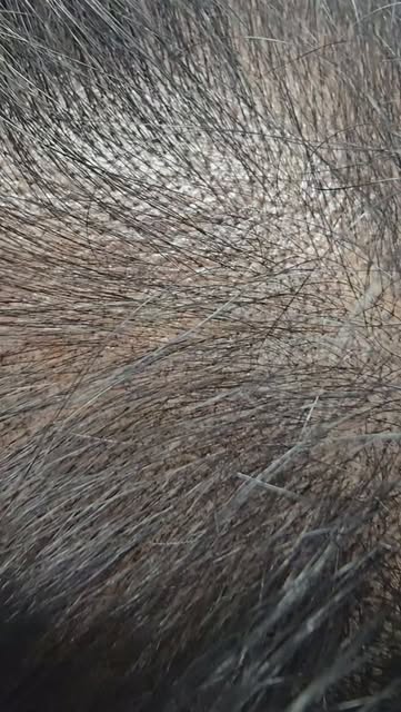 Super Duper Zoomed in Scalp Shading Impressions.  Powder mist impressions on the scalp to help darke
