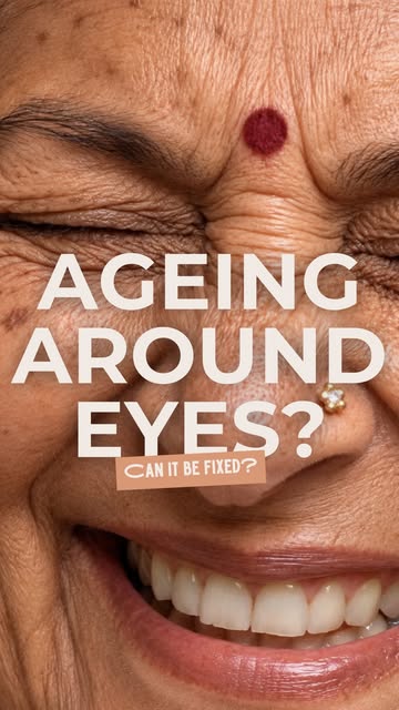 The eyes often show ageing before the rest of the face does.

Changes in the skin, fat, and surround