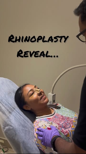 Day 6. Splint off. That smile says everything. 🤍

This is the moment every rhinoplasty surgeon live