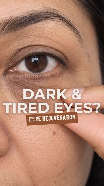 Upper eyelids are often one of the first areas where ageing becomes noticeable.

Loose skin, heavine