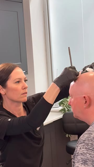 Big News! 🎉📺 We’re beyond excited to announce that our amazing Hair Loss Expert Emma Furlong will 