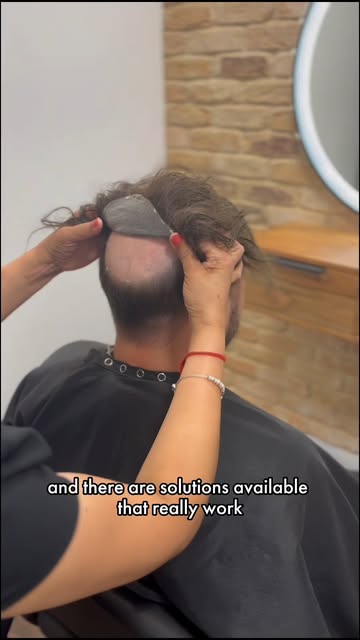 Hair loss affects every man differently, and there’s no one-size-fits-all solution. At Aderans, we’v