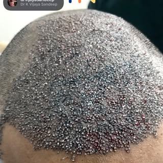 Three different cases. One common goal.
Natural, dense and age-appropriate results through customize