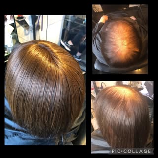 No need to suffer any longer with fine thinning hair. Consultations are free and private. #sharonral