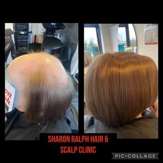 Just one of our hair loss solutions available in the salon. We offer private appointments on Wednesd
