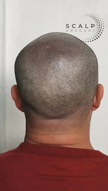 Efecto rapado, natural y uniforme.

Un resultado pensado para integrarse con el patrón natural del c