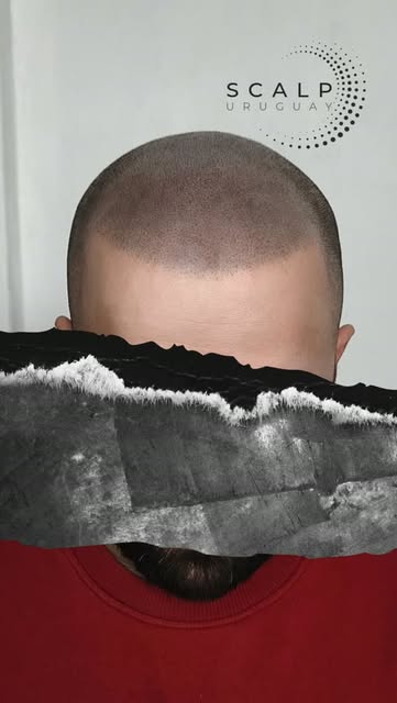 Efecto rapado, natural y uniforme.

Un resultado pensado para integrarse con el patrón natural del c