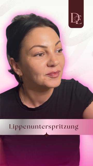 Da Vorher-Fotos leider nicht erlaubt sind, können wir diese nicht zeigen. Die Lippen unserer Patient
