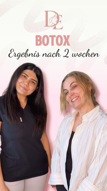 ✨ Natürliches Ergebnis nach einer Botox-Behandlung ✨

Ziel der Behandlung war es, die Mimikfalten si