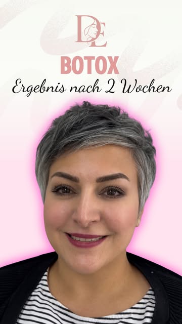 ✨BOTOX❤️

#berlinbotox #botoxberlin #berlinlips #berlinlippenmithyalouron #berlinlippen