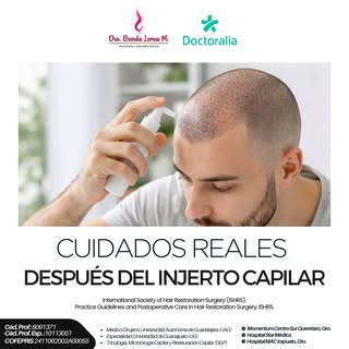 💇‍♂️✨ CUIDADOS REALES después del injerto capilar
Porque el injerto no termina el día de la cirugía